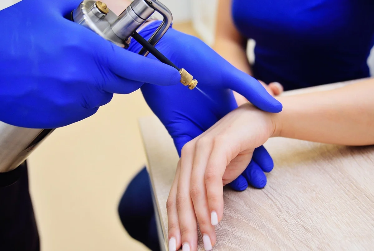 what is cryotherapy used for